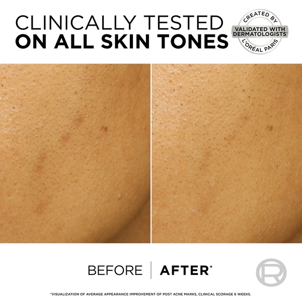  L'oréal Paris L'oréal Paris Bright Reveal Peeling Esfoliante Viso Anti-macchie Con 25% Di Aha + Bha + Pha E Niacinamide 25 Ml 